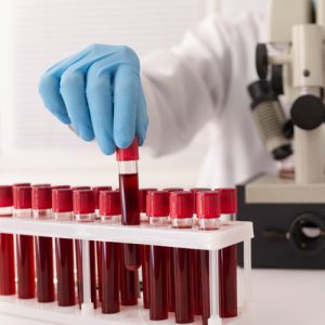 Blood Test