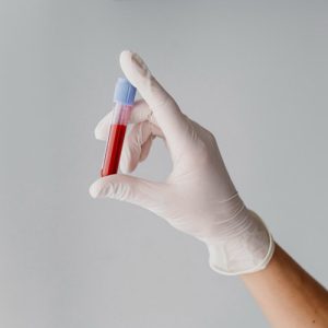 Blood Test
