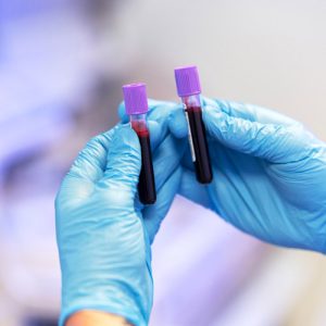 Blood Test
